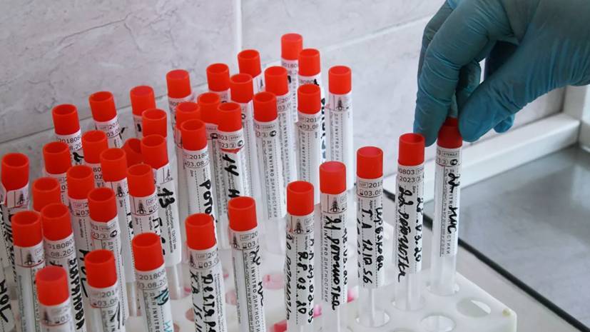 Число заражённых коронавирусом в Дагестане возросло до 92