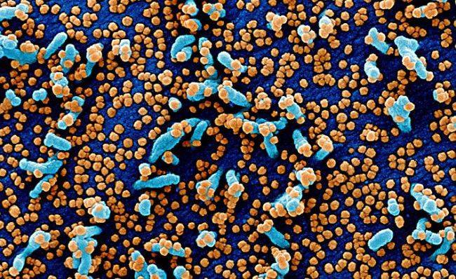 Forskning: Как долго коронавирус выживает на поверхностях и в воздухе