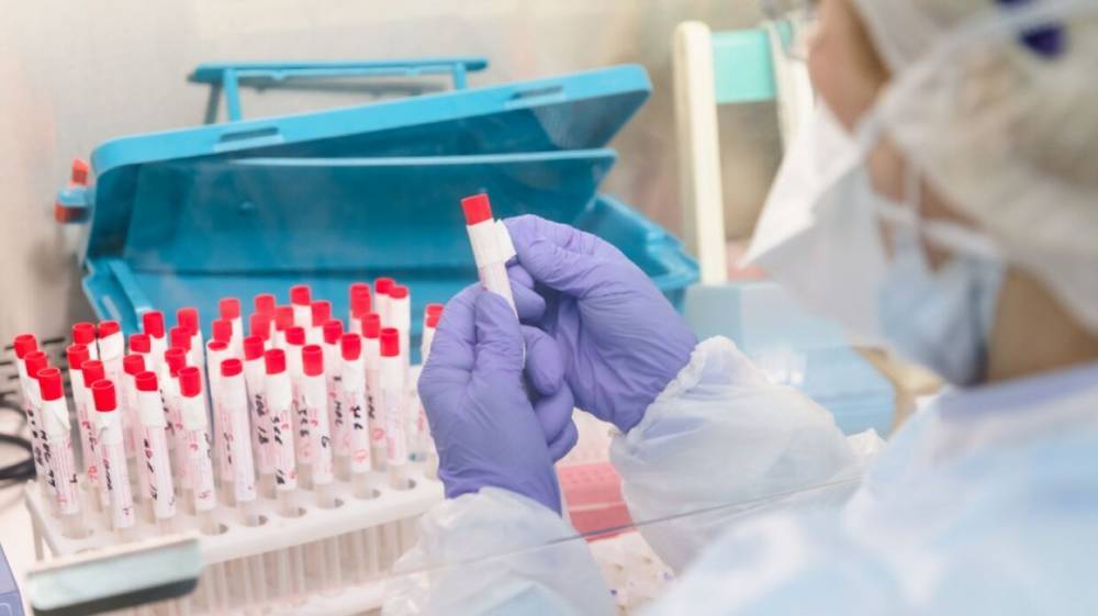 В Удмуртии подтвердились 15 новых случаев заражения коронавирусом