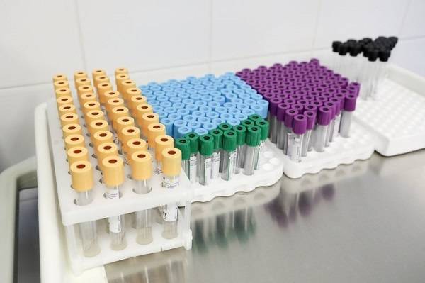 Тест на антитела к коронавирусу появится в российских лабораториях в течение 10 дней