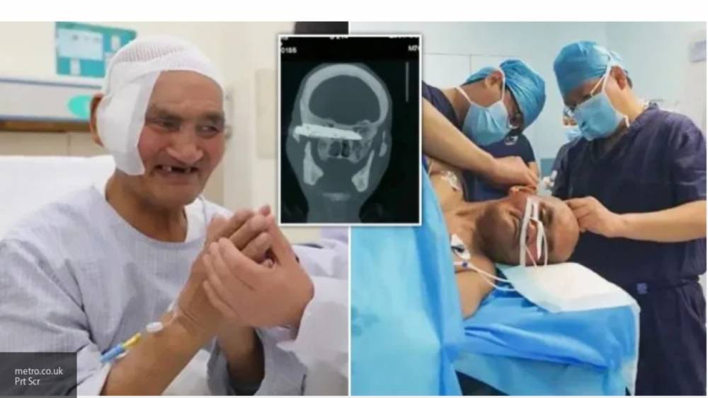 Китайские врачи вытащили находившийся 26 лет в голове у пациента нож