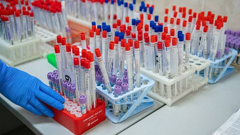 Разработчик рассказал подробности о новом экспресс-тесте на коронавирус