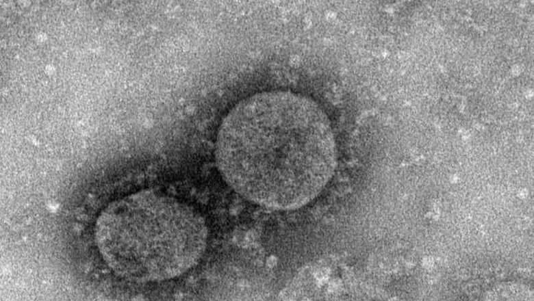 Ученые определили температуру гибели коронавируса