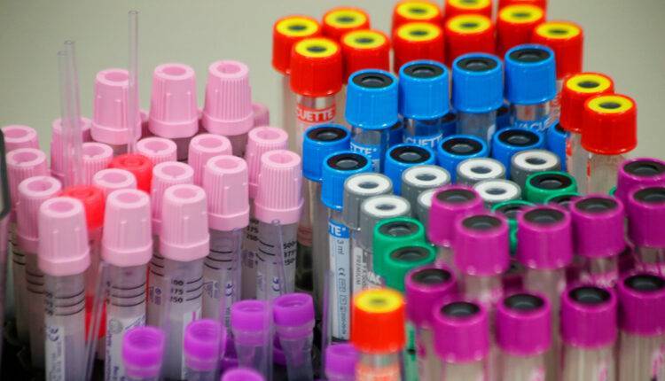 Мурашко сообщил о начале доклинических испытаний вакцин от коронавируса