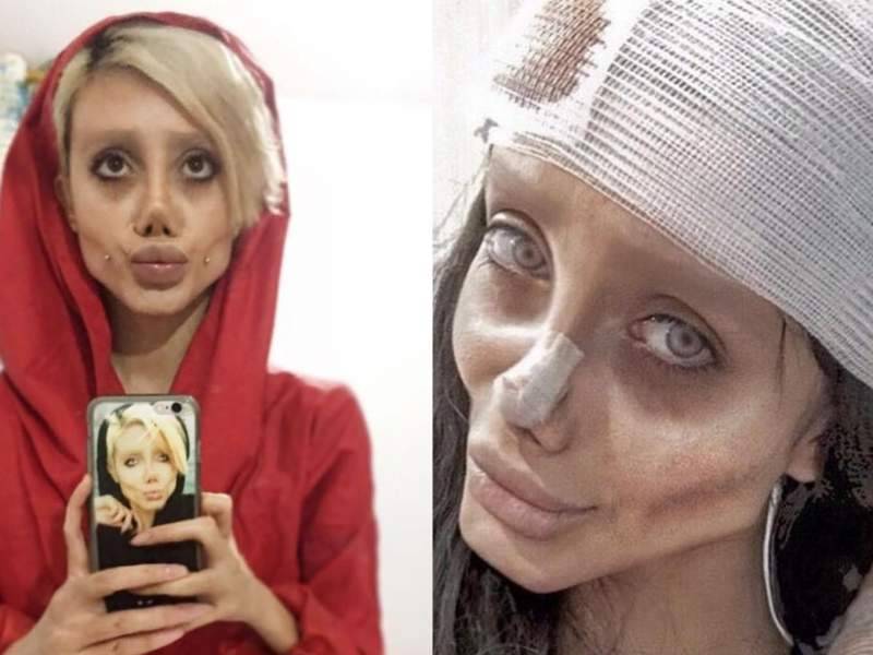 "Иранская Джоли" заразилась коронавирусом в тюрьме: ее подключили к ИВЛ