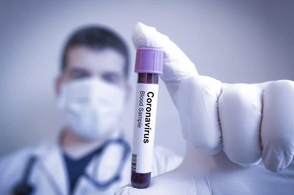 Власти Великобритании начнут массовое производство вакцины от коронавируса, не прошедшей клинические испытания
