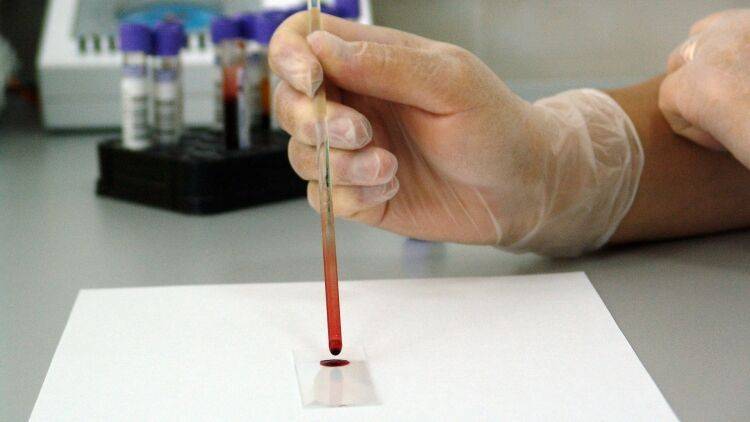 Онищенко оценил метод забора крови переболевших COVID-19 для борьбы с вирусом