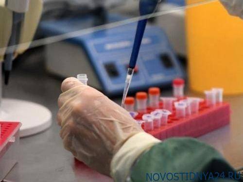Диагноз «коронавирус» подтвердился еще у трех человек в Вологодской области