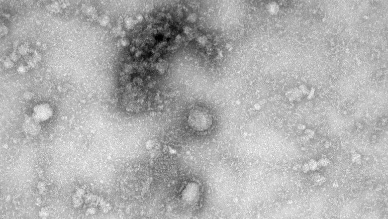 «Все непонятное – страшно»: инфекционист ФМБА рассказал о странностях коронавируса