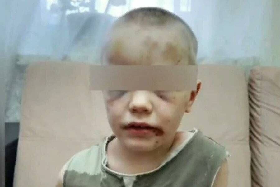 В Новороссийске в затопленной квартире нашли избитого до полу-смерти ребёнка