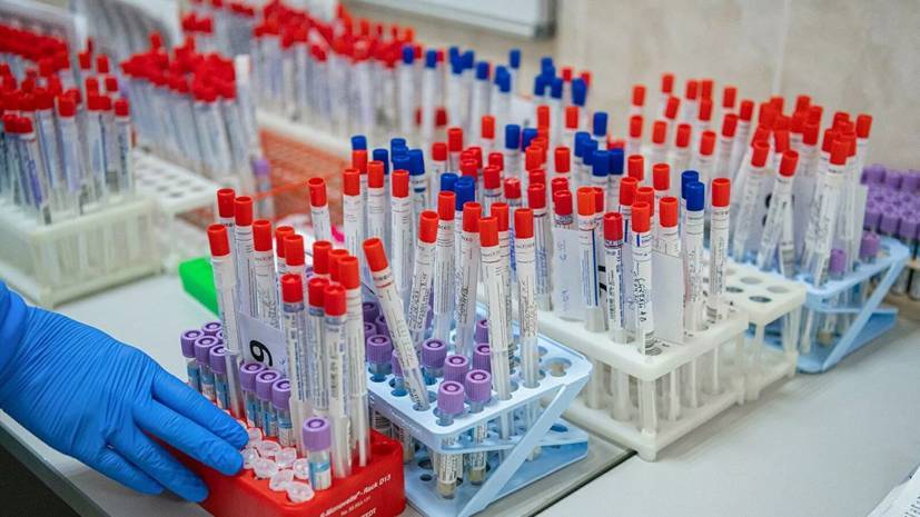 В Нижегородской области помогут создать экспресс-тесты на коронавирус