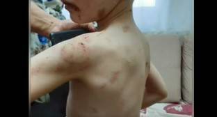 Дело об избиении ребенка на Кубани вызвало у следствия вопросы к службе опеки