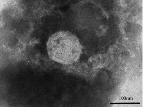 В Ухане экспериментировали, соединяя частицы коронавируса и ВИЧ