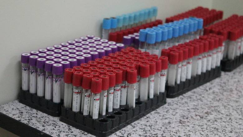 В Великобритании заявили об испытаниях вакцины от коронавируса на людях
