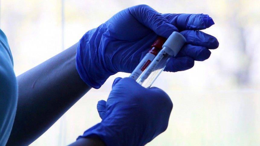 Массовое тестирование на антитела к коронавирусу запустят в мае