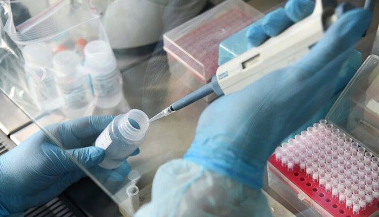 Ученые назвали сроки появления на рынке тестов на антитела к коронавирусу