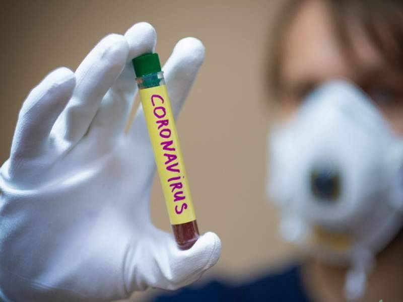 Две трети умерших от коронавируса в Москве поздно обратились к врачу