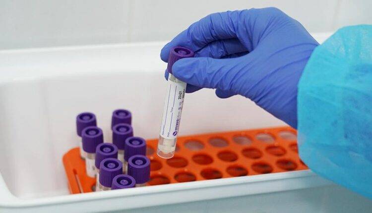 В России тест на COVID-19 можно сделать в 438 лабораториях