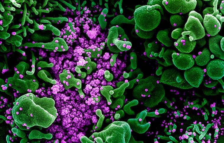 Учёные обнаружили уязвимые для коронавируса клетки человека