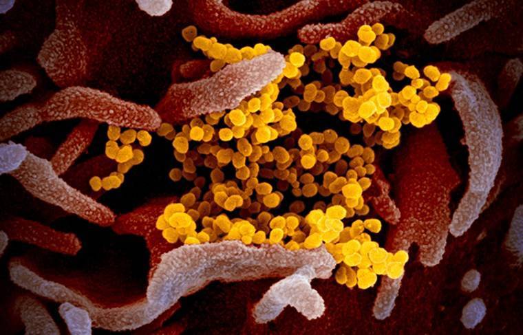 Пульмонолог рассказал о необычном течении пневмонии при коронавирусе