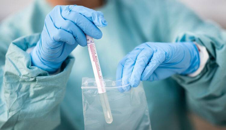 Тест на антитела, нейтрализующие коронавирус, будет зарегистрирован на следующей неделе