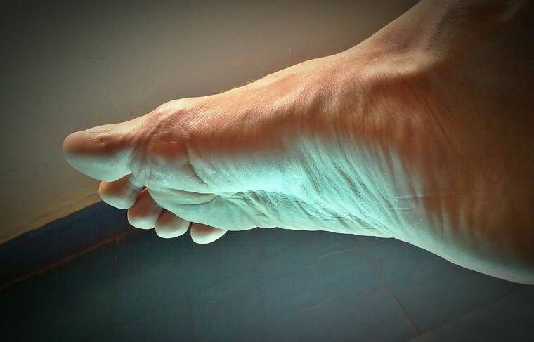 Посинение пальцев ног оказалось симптомом COVID-19