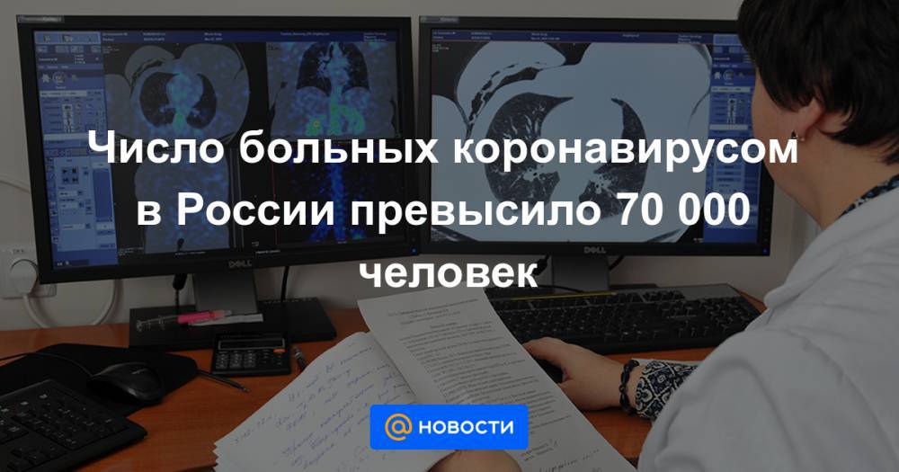 Число больных коронавирусом в России превысило 70 000 человек