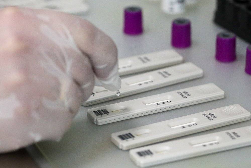 Около 100 тысяч экспресс-тестов на иммунитет к COVID-19 доставили в Москву