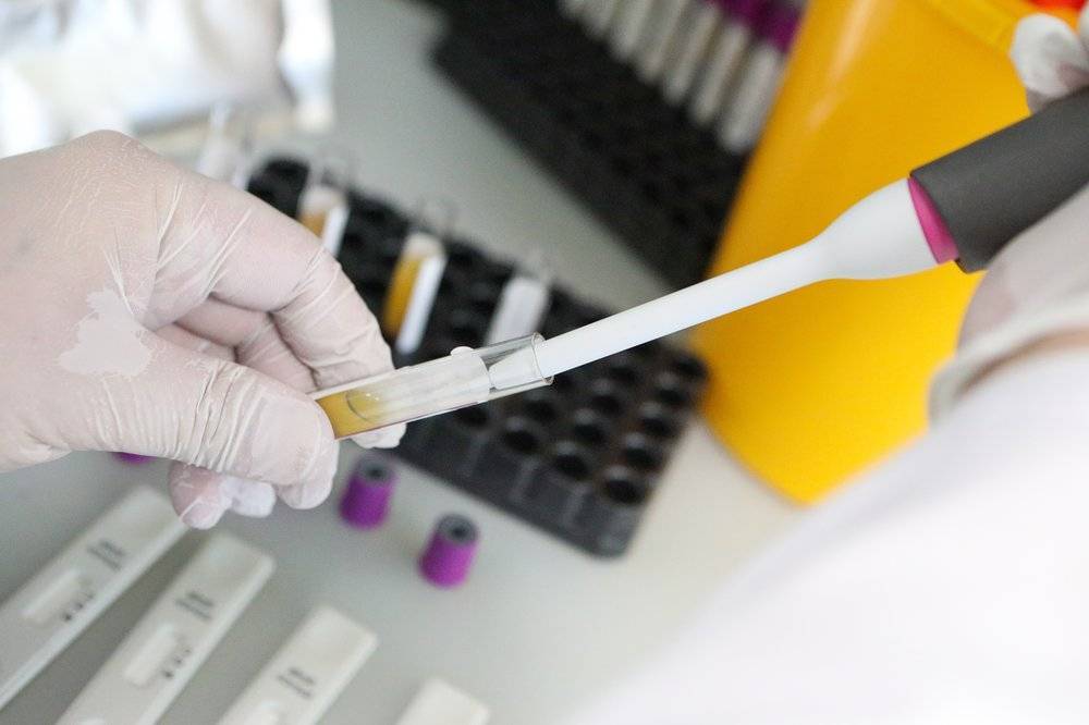 В Москве в сутки проводят 25 тысяч тестов на коронавирус