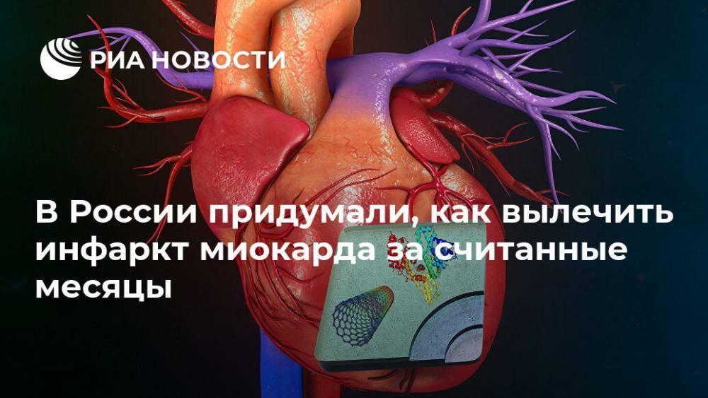 В России придумали, как вылечить инфаркт миокарда за считанные месяцы
