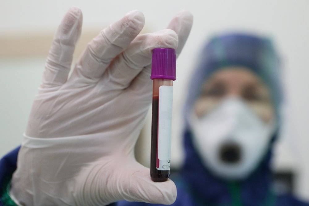 Тесты на коронавирус начнут проводить с помощью анализа крови