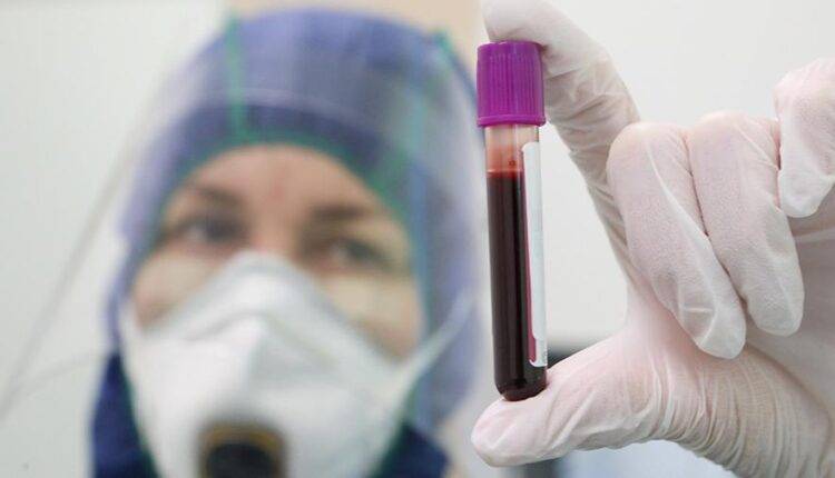 В России приступили к лечению коронавируса новым методом