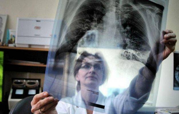 Минздрав Украины: «Реформы» Супрун привели к угрозе эпидемии туберкулеза