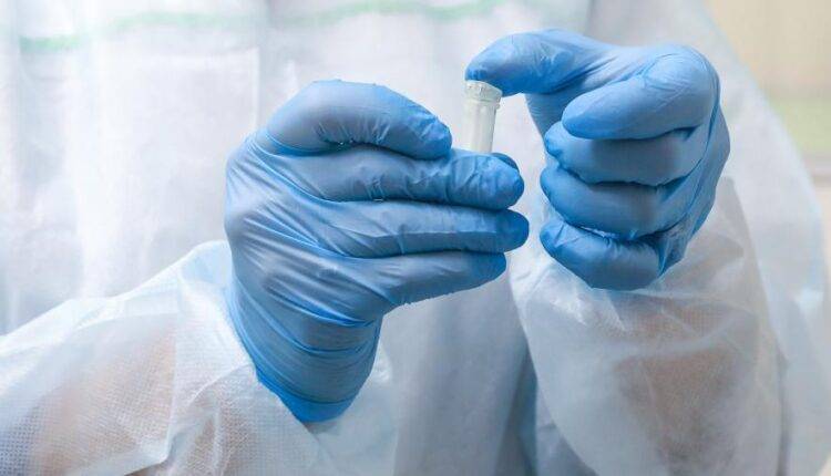В России проведено более 3,4 млн тестов на коронавирус