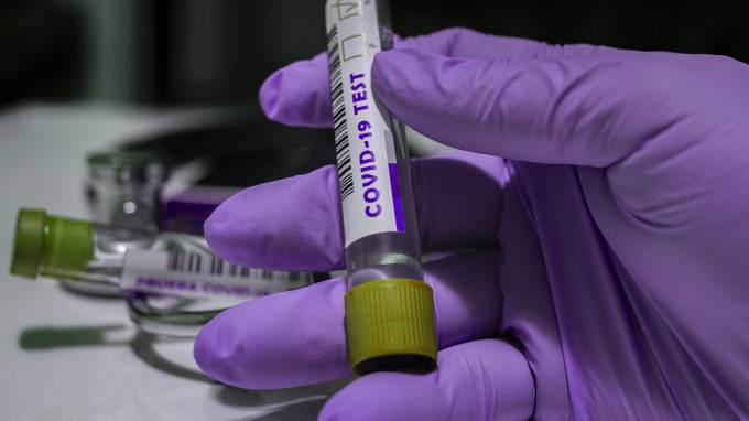 Петербуржцы смогут бесплатно сдать тест на коронавирус на дому
