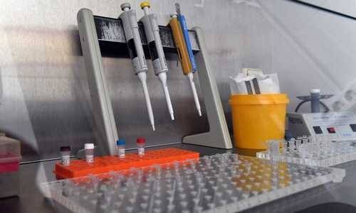 Новые случаи коронавируса выявлены в восьми муниципалитетах ХМАО