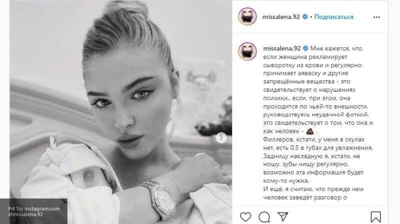 Алена Шишкова рассказала о "нарушениях психики" у раскритиковавшей ее Бони