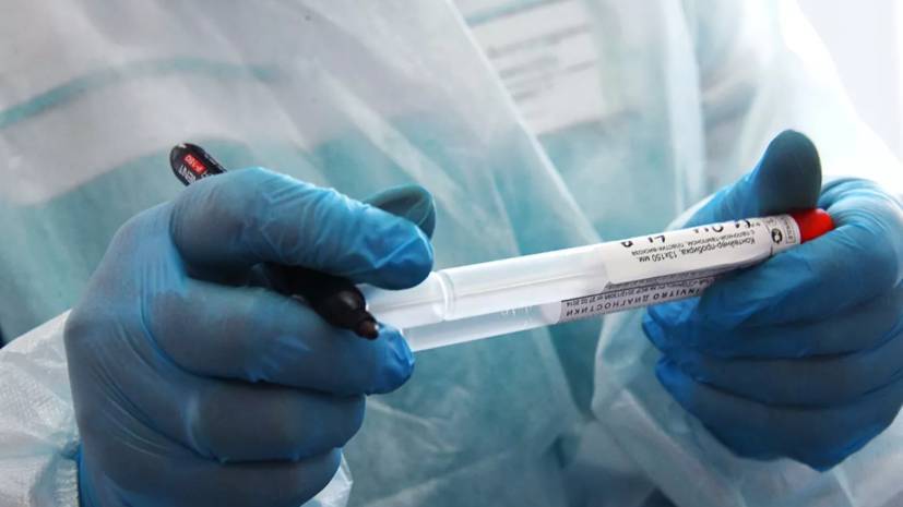 Пилотное применение новых тестов на коронавирус могут начать в апреле