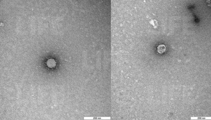 Испытана вакцина, не дающая коронавирусу присоединяться к клеткам