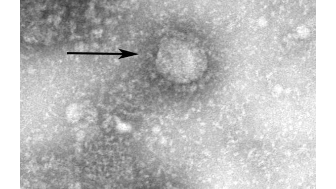 Российские ученые признали свою ошибку о мутациях коронавируса