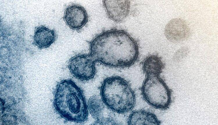 Ученые подтвердили способность коронавируса вызывать некроз мозга