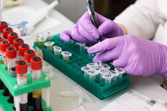Австралийские учёные нашли препарат, подавляющий коронавирус за двое суток