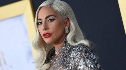 «Баба Гага»: Певица показала неутешительные последствия пластики
