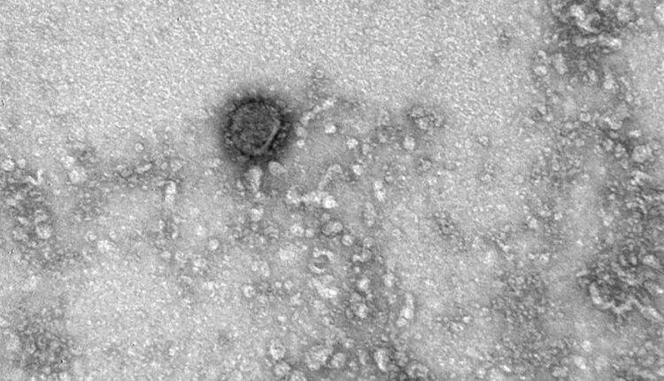 В ВОЗ заявили о риске заражения коронавирусом даже при наличии антител