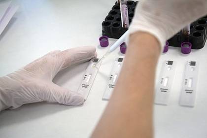 Обозначены сроки появления в Москве бесплатных тестов на антитела к коронавирусу