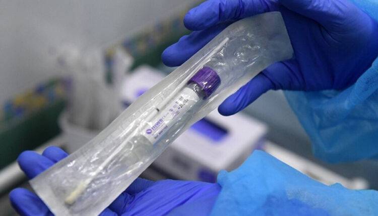 Росздравназдор зарегистрировал тест на антитела к коронавирусу