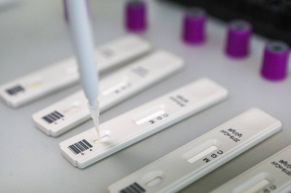 Тест-систему на антитела к COVID-19 зарегистрировали в России