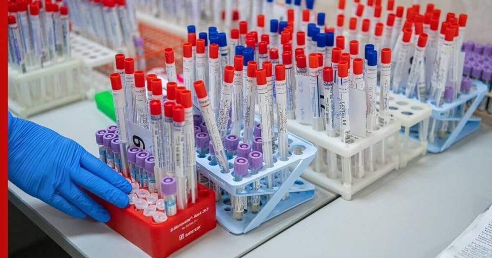В России зарегистрирована тест-система для определения антител к COVID-19