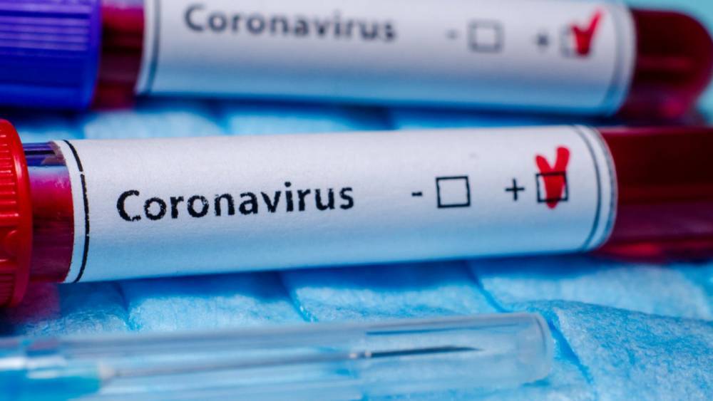 Зарегистрировано 20 новых случаев заражения коронавирусной инфекцией в Казахстане