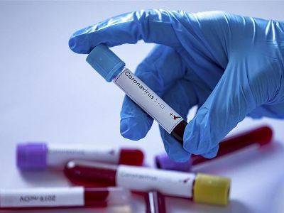 В Росии за последние сутки выявлено более 11 000 случаев заражения коронавирусом